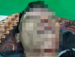Tabrak Lari di Pidie, Satu Pengendara Motor Asal Aceh Selatan Meninggal