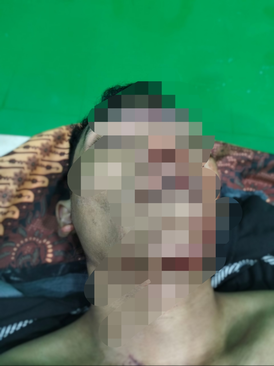 Tabrak Lari di Pidie, Satu Pengendara Motor Asal Aceh Selatan Meninggal