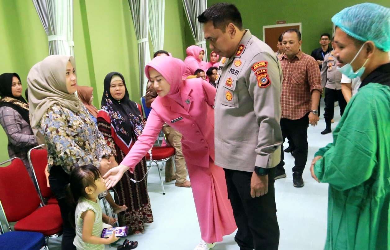 Polres Aceh Barat Gelar Operasi Bibir Sumbing Gratis