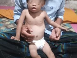 Balita 22 Bulan Asal Aceh Jalani Pengobatan Jantung di RS Harapan Kita