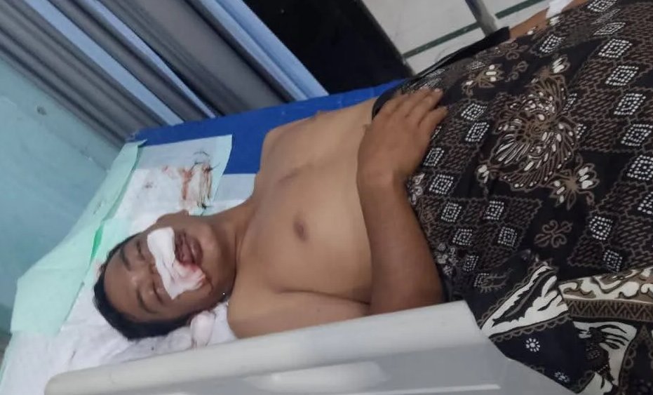 Petani di Putri Betung Diterkam Harimau