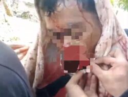 Warga Gayo Lues Diserang Harimau Saat Bersihkan Kebun